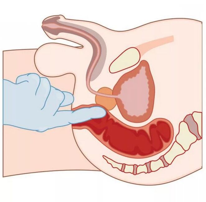 Ubicación del punto G masculino